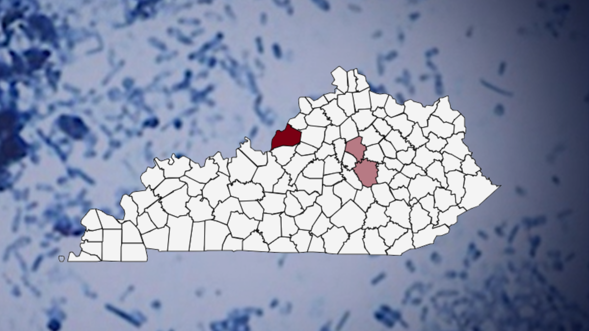 Kentucky experiencing more than 400% increase in cyclosporiasis cases in 2026