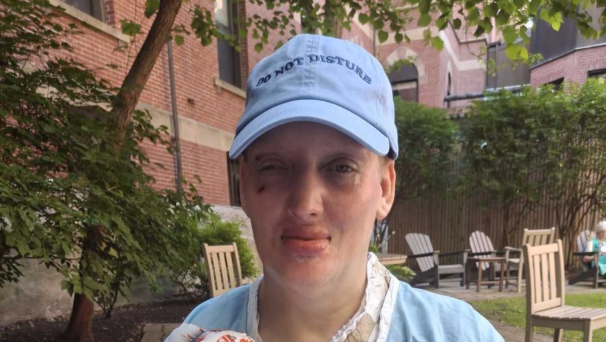Firefighter burned in Maine lumber mill fire to be released from the ...