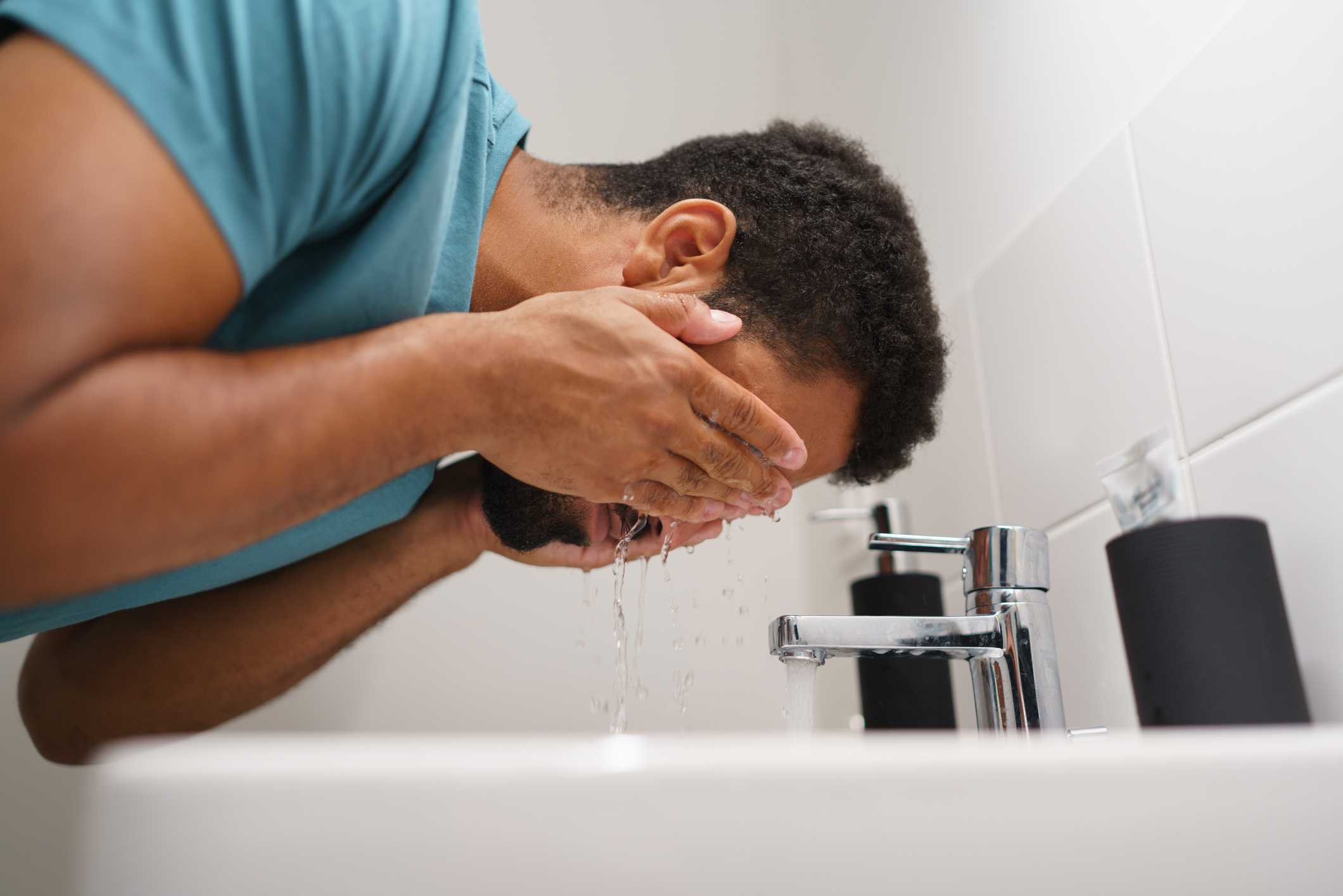 Adult acne is real, but there are ways to treat it