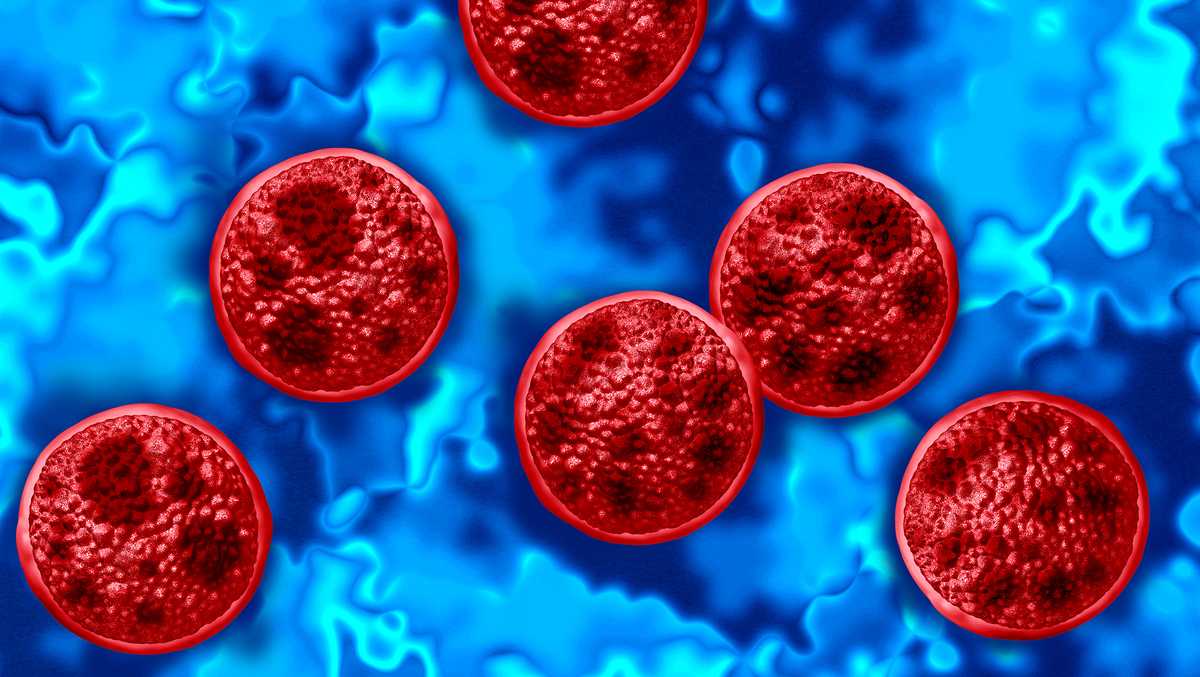 Cyclospora infection reported in Mississippi, linked to fresh produce