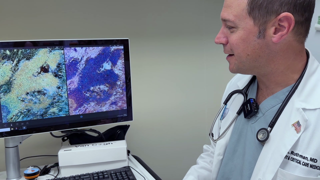 NCH doctors use AI-powered biopsy tool to diagnose lung cancer