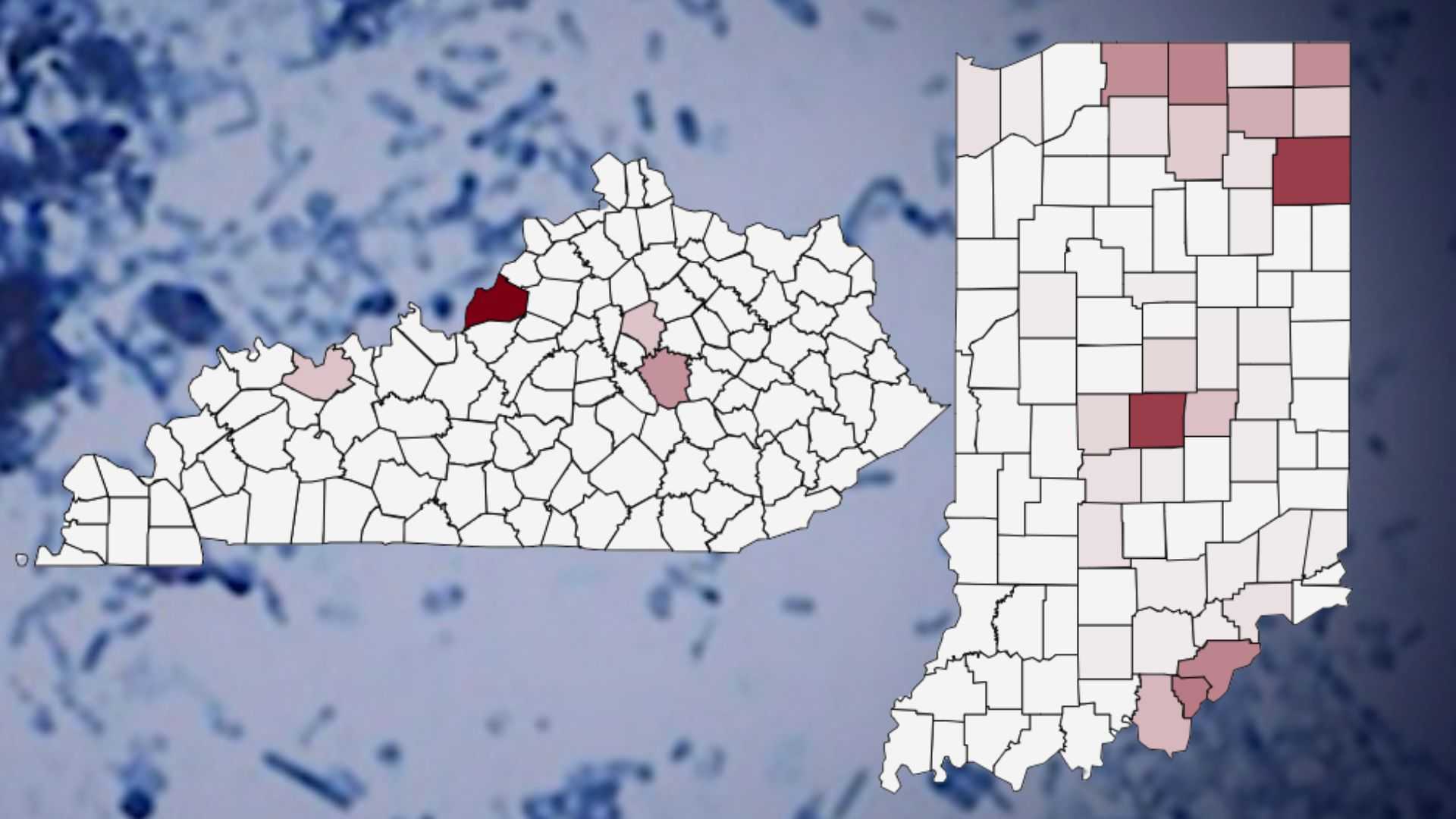 Cyclospora cases in Indiana, Kentucky | Check the county-by-county breakdown