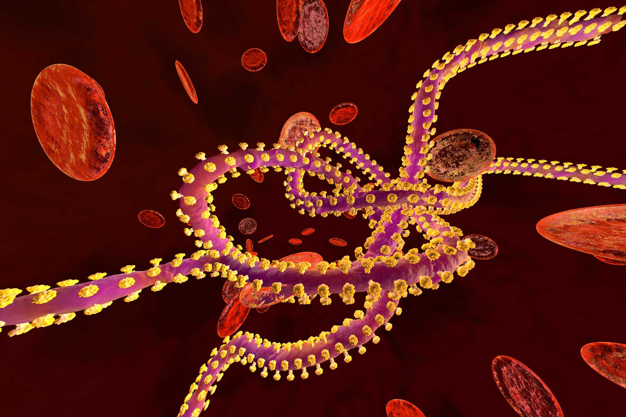 Tracking the Ebola outbreak in Congo, Uganda