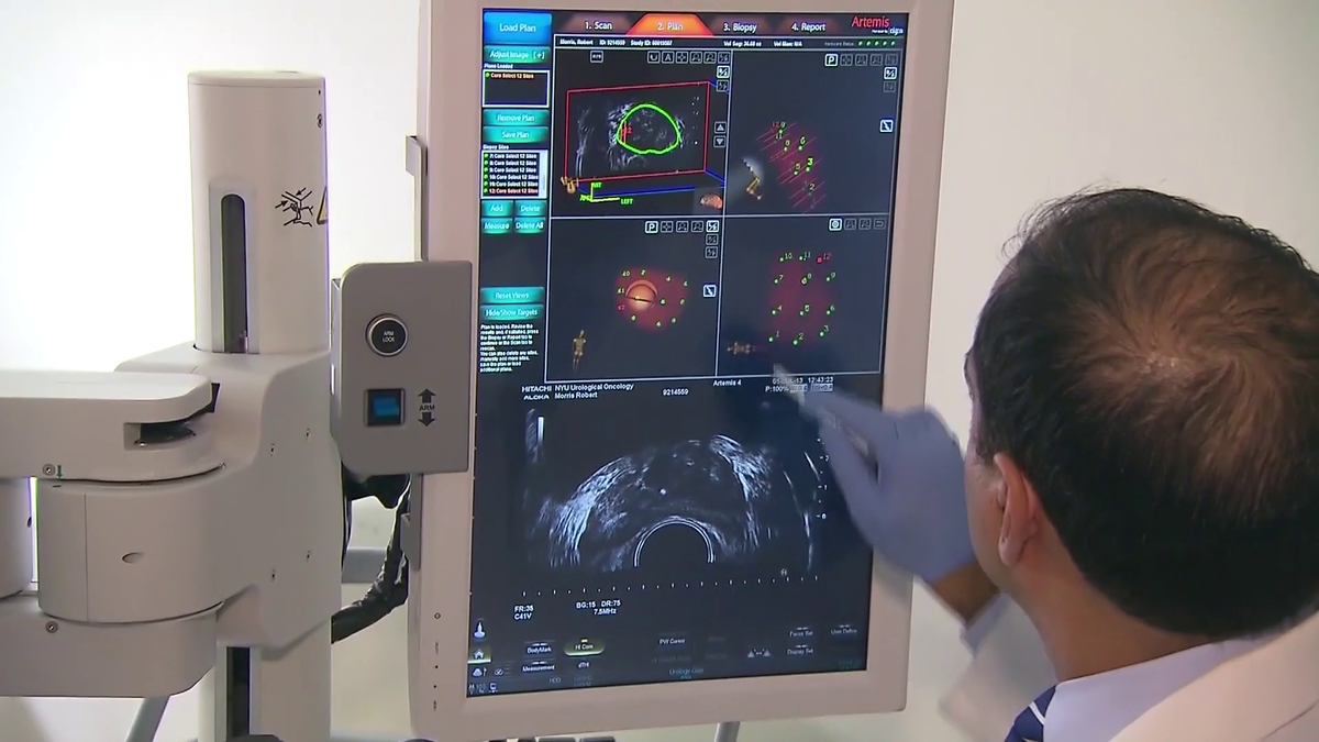 Photo: WCVB colorectal cancer screening