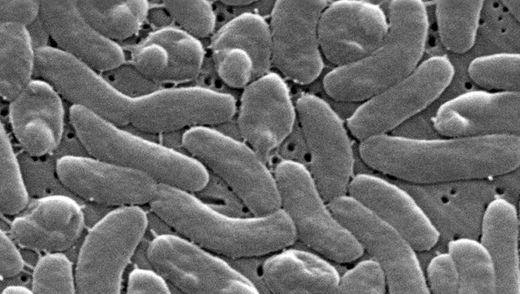 Marion County resident dies after contracting Vibrio , FDOH says