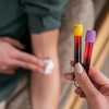 Routine blood testing may hold hidden clues to colorectal cancer before age 45