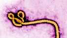 Ebola virus microscope