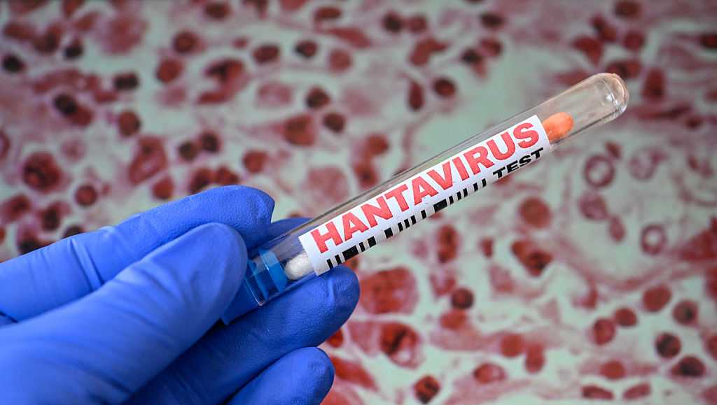 North Carolina health leaders to give latest on hantavirus response and preparedness