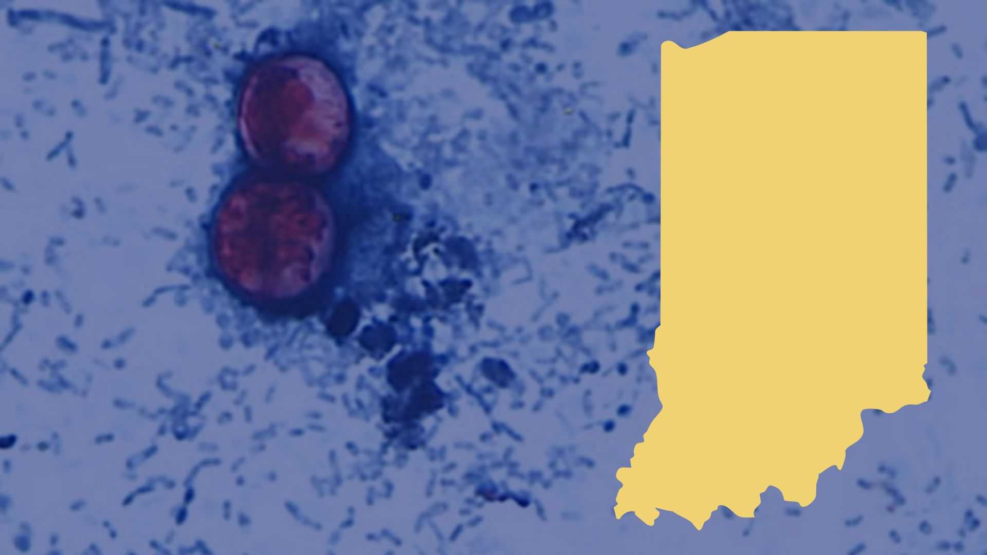 Indiana reporting 250+ Cyclosporiasis cases, illness causing 'explosive diarrhea'