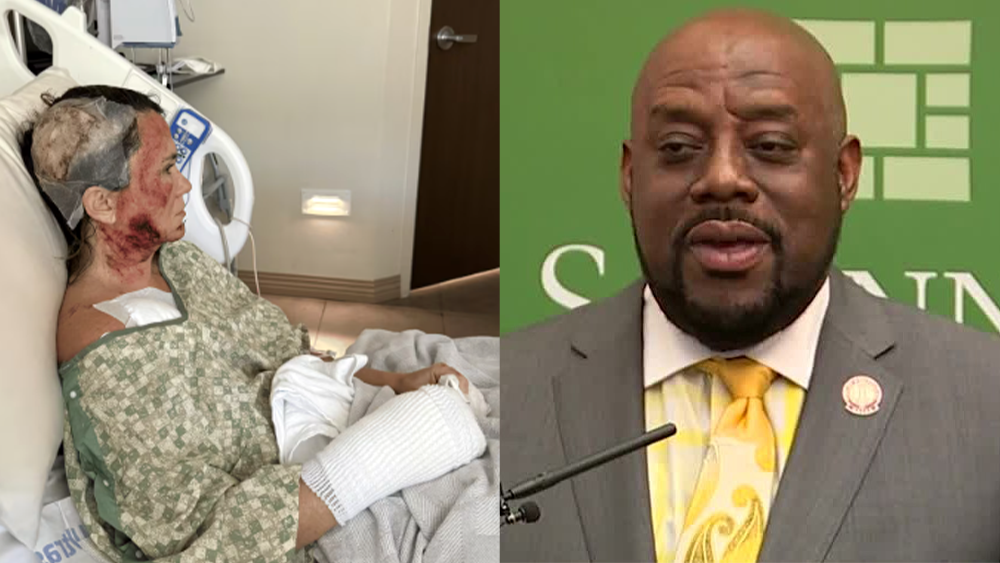 Savannah acid attack victim criticizes mayor over public comments, withholding suspect information