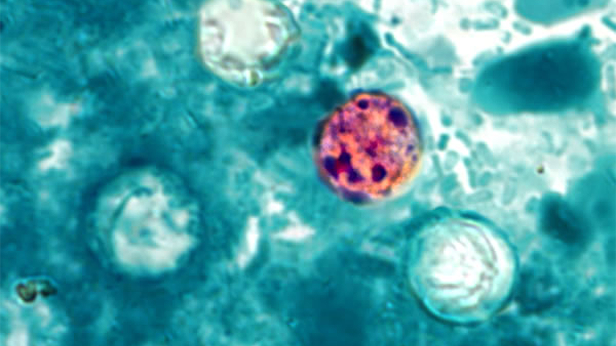 Cyclospora outbreak linked to more states, including Pennsylvania