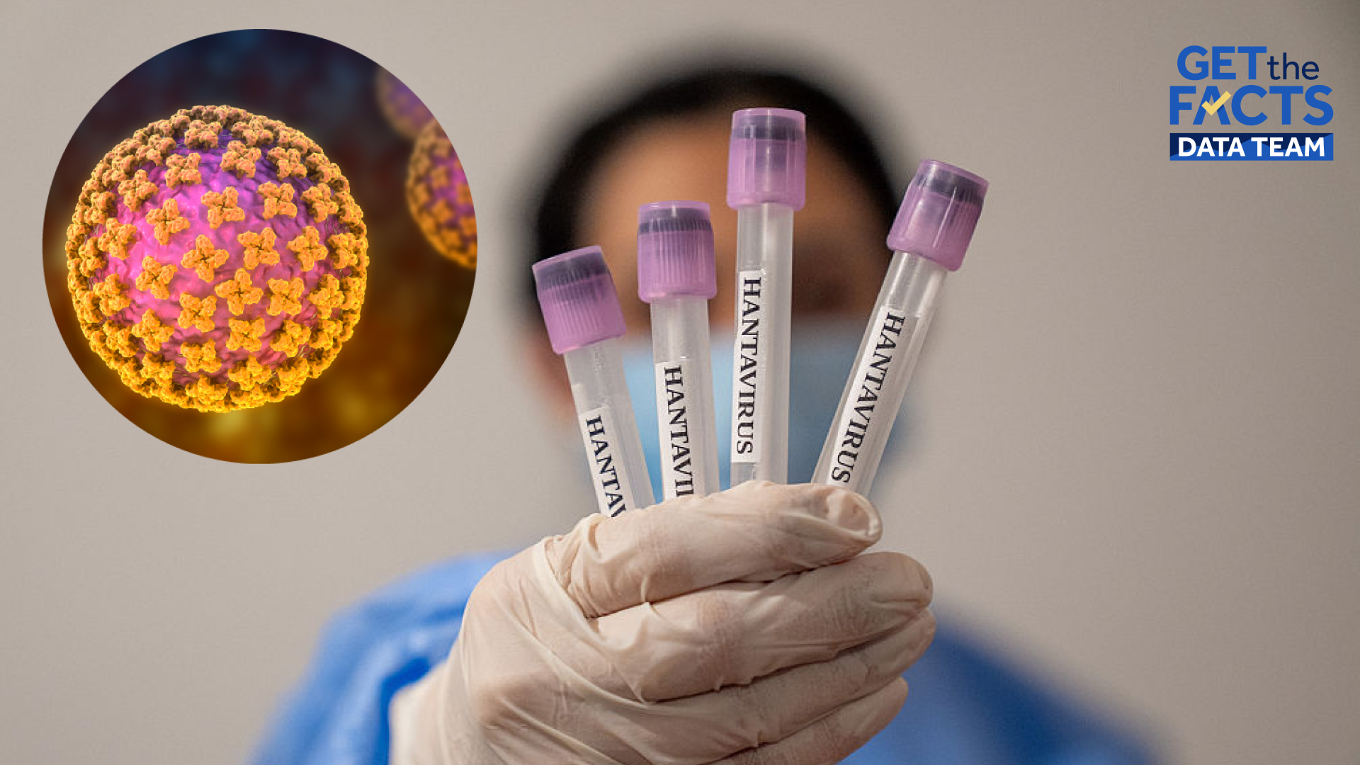 Here's how many past hantavirus cases were reported in the US