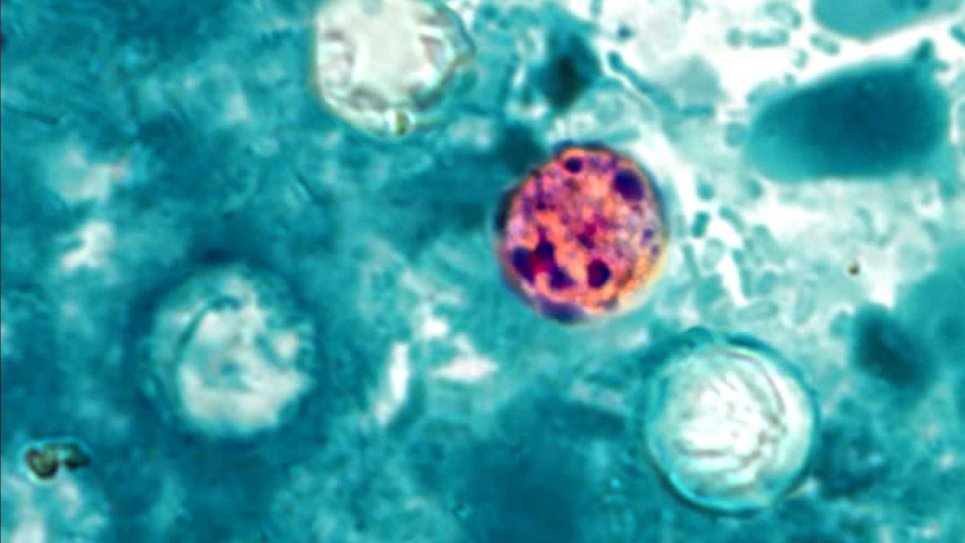 Cyclosporiasis outbreak linked to shredded iceberg lettuce expands to Nebraska, Iowa