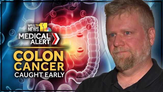 'What just happened?': Maryland man learns colon cancer was caught early after routine colonoscopy
