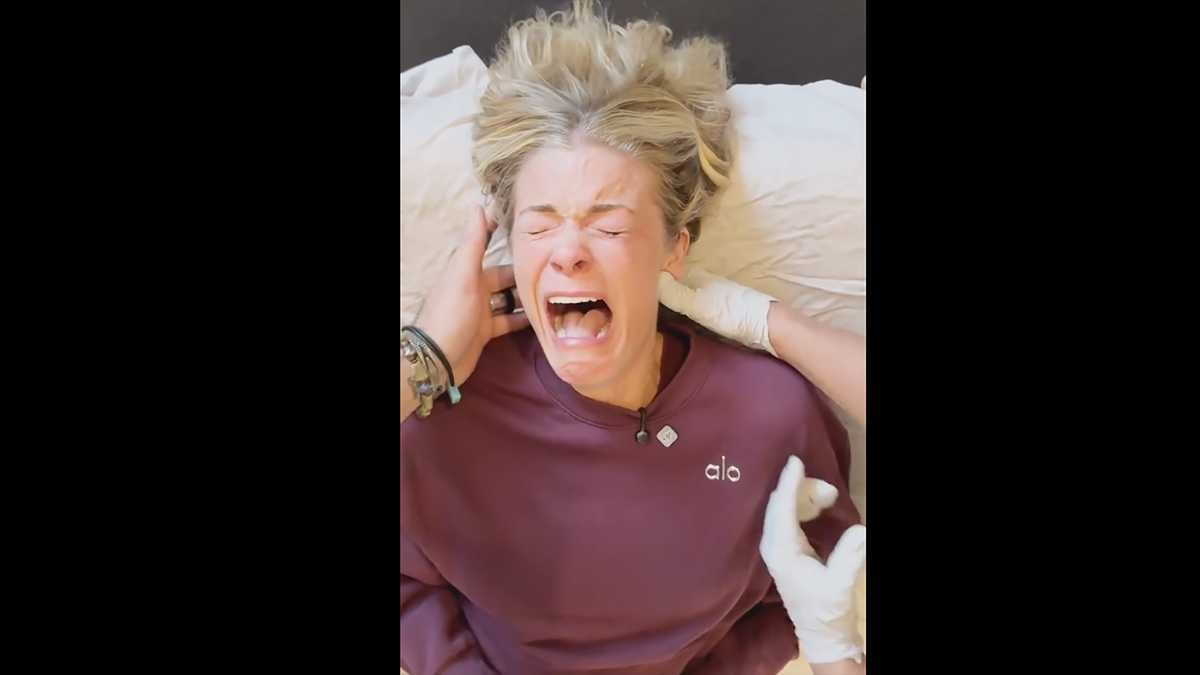 Mississippi native LeAnn Rimes goes viral after emotional reaction during jaw treatment