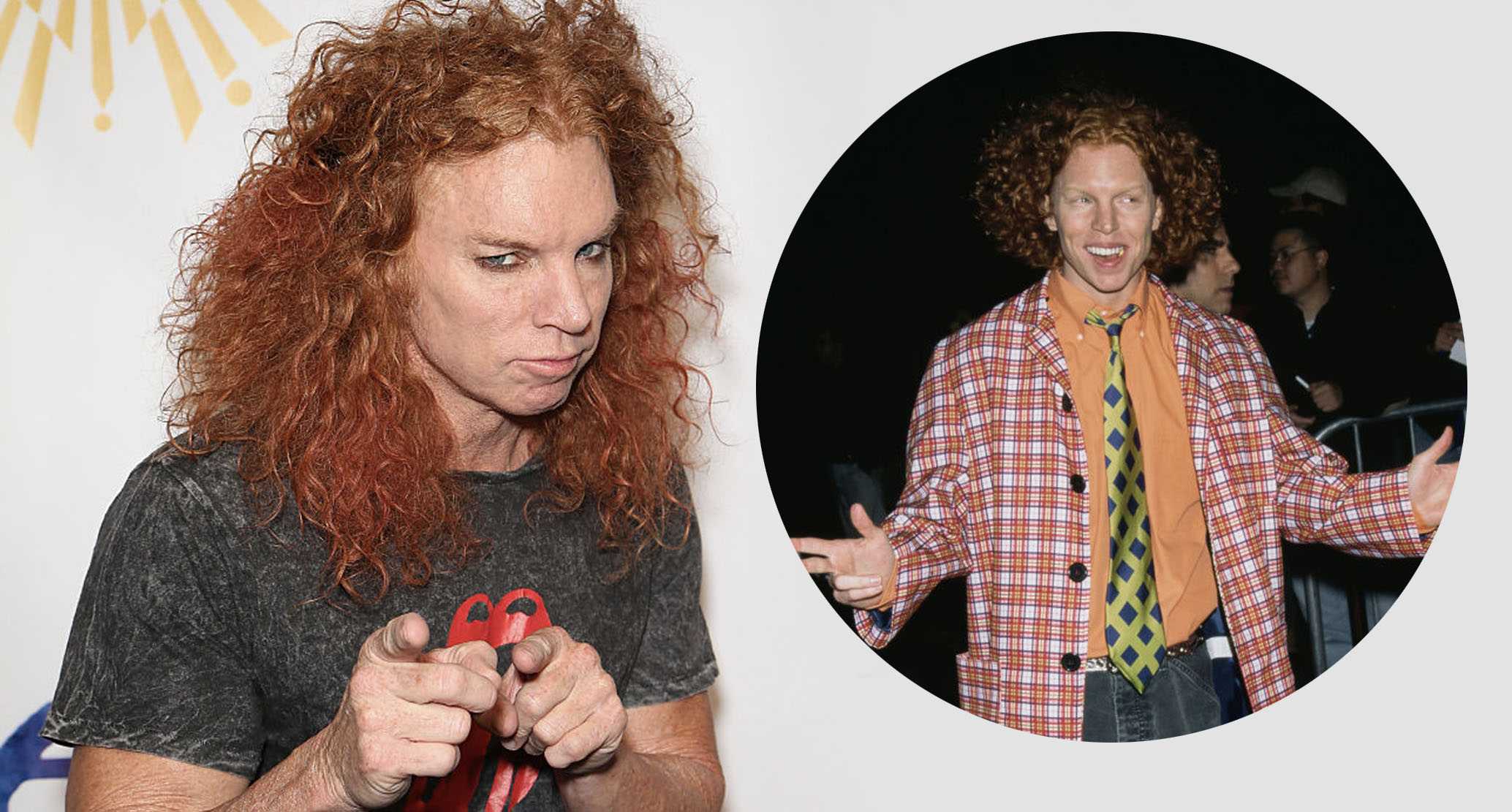 Comedian Carrot Top hospitalized in Las Vegas, receiving ‘care and support he needs’