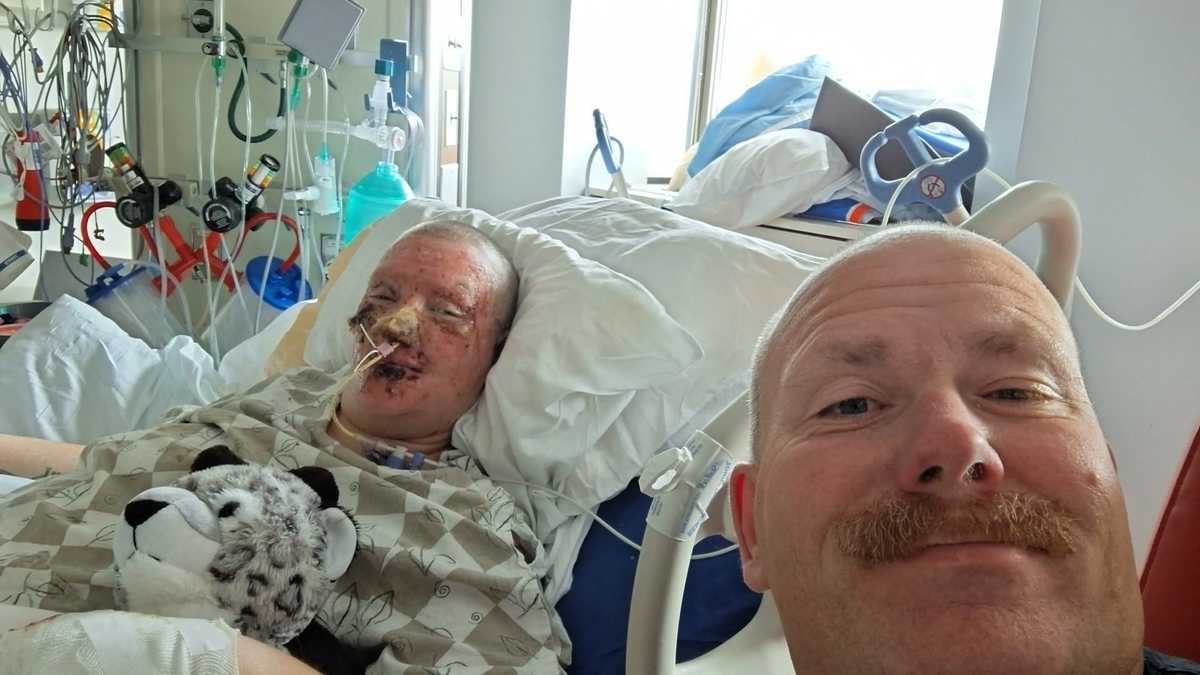 Husband of firefighter injured in Searsmont explosion highlights 'small steps' in recovery