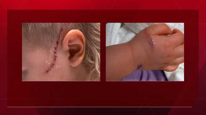 omaha family gives update on boy slashed during attempted abduction