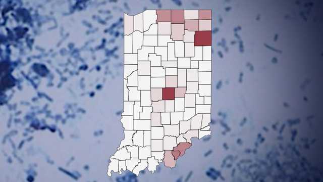 Interactive map: Tracking Cyclospora cases in Indiana