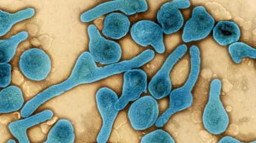 A color-enhanced electron micrograph depicts Marburg virus particles in blue at the NIAID Integrated Research Facility in Fort Detrick, Maryland.