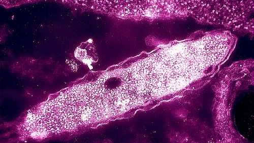 NYC Legionnaires' disease cluster grows to more than 100 cases, including 4 deaths