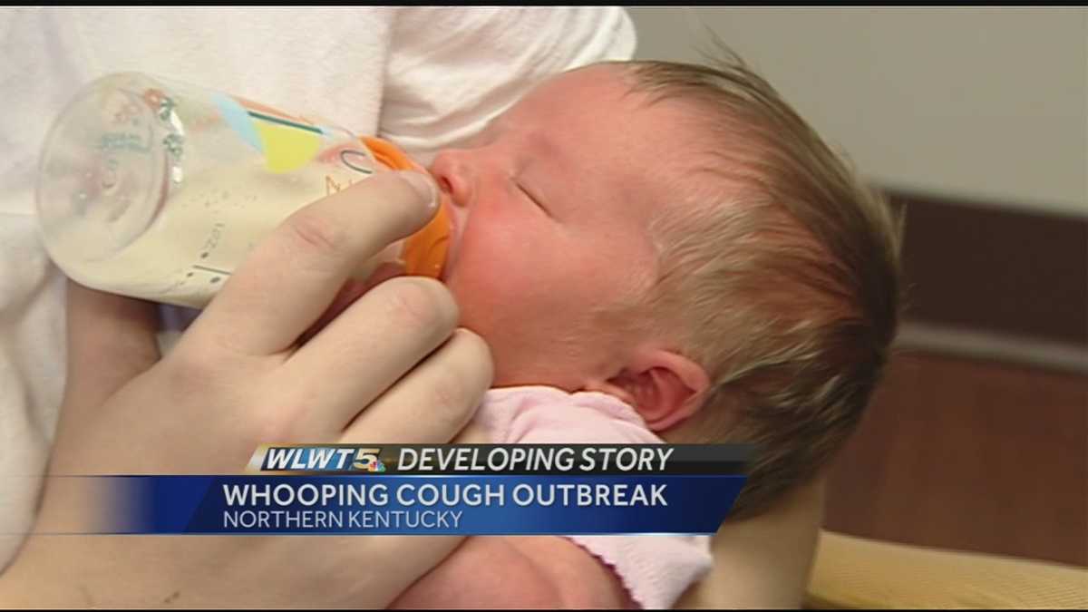 Cases of whooping cough spiking in NKY, health department says