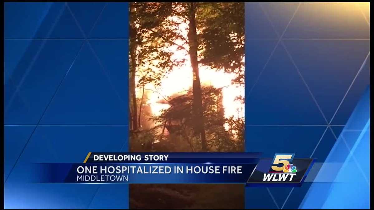 Man injured in overnight house fire