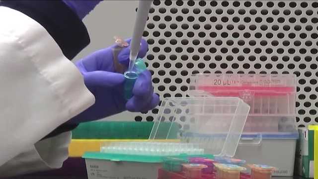 Simple blood test could reveal hidden heart attack and stroke risk