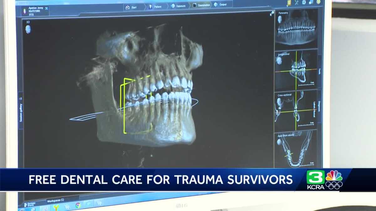 survivors-of-domestic-violence-get-free-dental-treatment-in-sacramento