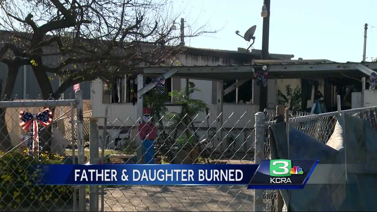 Man, daughter burned in Modesto mobile home fire