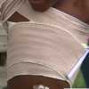 ONLY ON: Birmingham mom demands answers after hot coffee severely burns non-verbal son at school