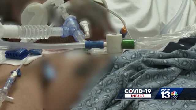 Alabama doctors explain importance of not purposely catching COVID-19 - Vimarsana News