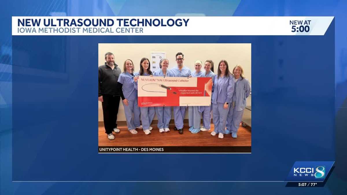 Iowa Methodist among first in state to use advanced 4D heart imaging technology