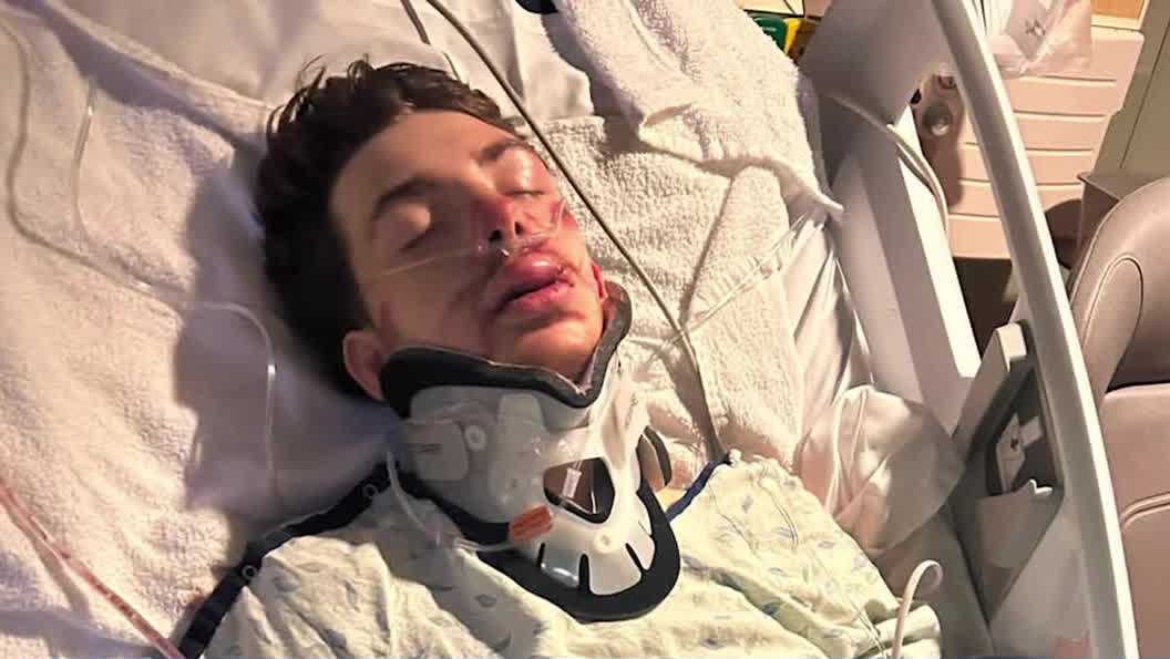 'It’s just inhumane': 18-year-old recovering at home after hit-and-run; woman arrested