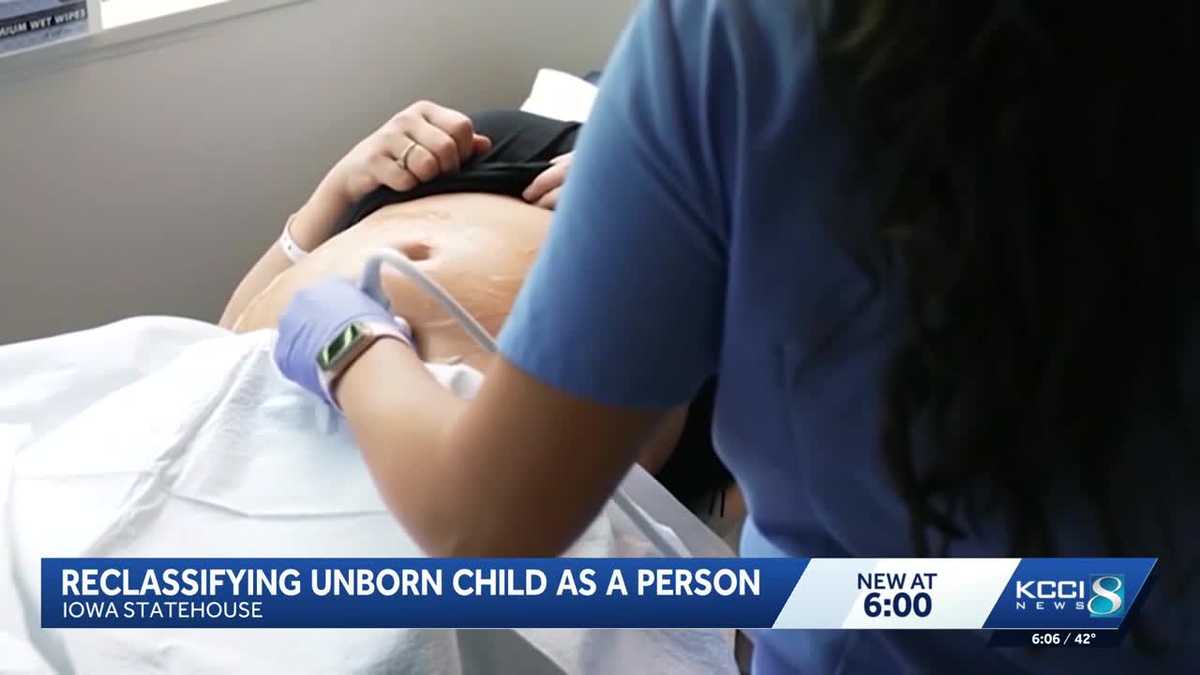 Iowans rally for abortion ban proposal at Capitol Rotunda