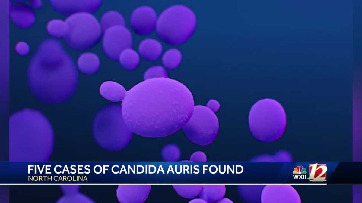 北卡罗来纳州报告了耐药真菌感染病例