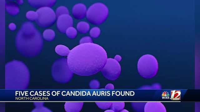 Drug-resistant fungal infection cases reported in NC - Vimarsana News
