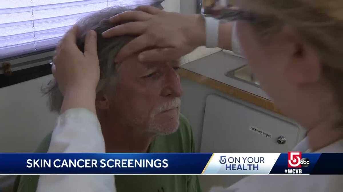 Dermatologists bring skin cancer screenings to beach