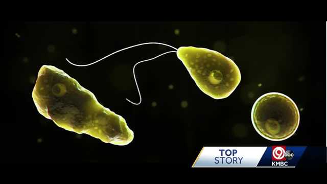Missouri resident infected with brain-eating amoeba has died - Vimarsana News