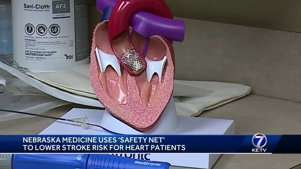 New Device Reduces Stroke Risk For Heart Patients