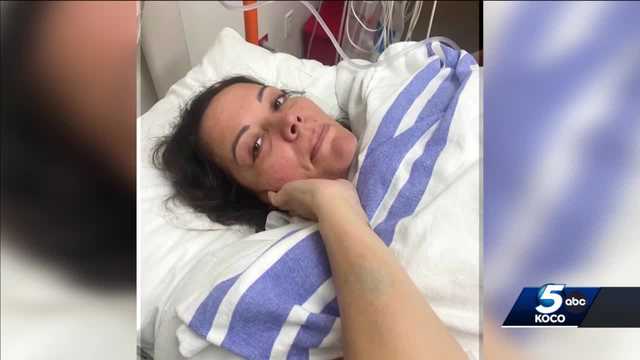 Shawnee mom shares story of resilience after suffering stroke at 41 - Vimarsana News