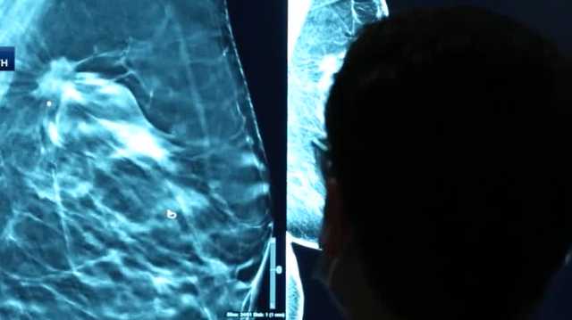 UofL oncologist says patients are putting off important health screenings - Vimarsana News