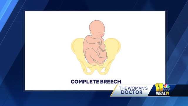 Can a 'breech' baby correct itself before birth? - Vimarsana News