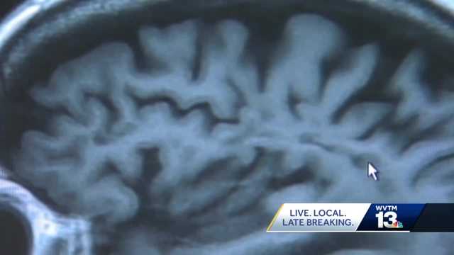 Alzheimer's Study UAB - Vimarsana News