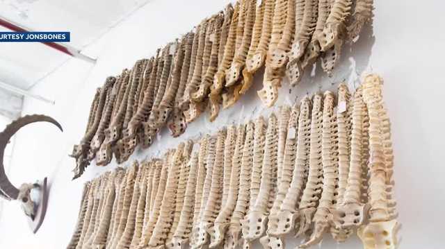 Legal bone business owner calls NH case 'appalling' - Vimarsana News