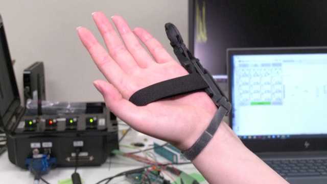 Scientists Create 6th Finger Augmentation - Vimarsana News