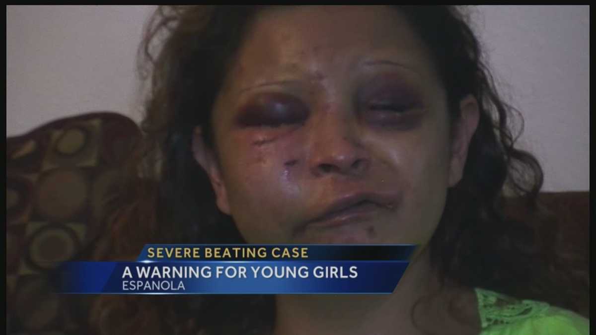 Ejendommelige Janice sidde Severe beating case: A warning for young girls