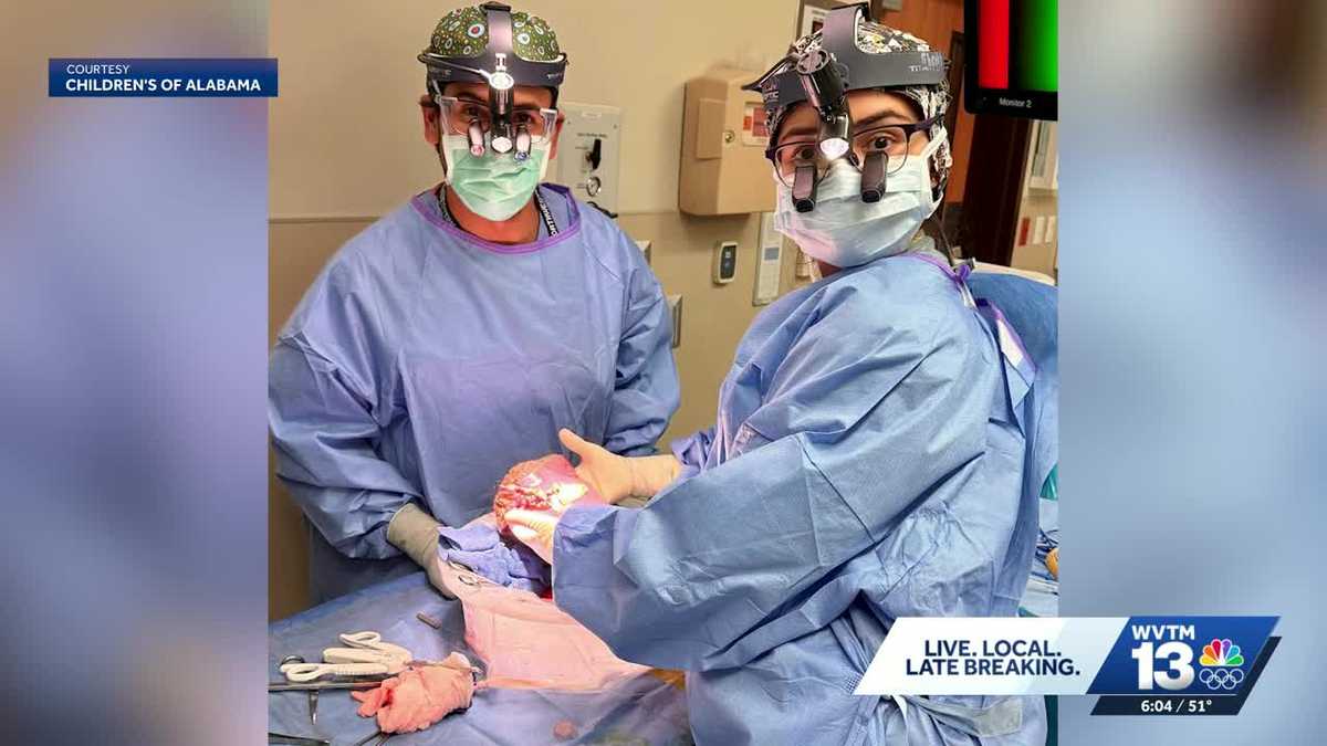 Split-liver transplant marks milestone for Children's and UAB hospitals
