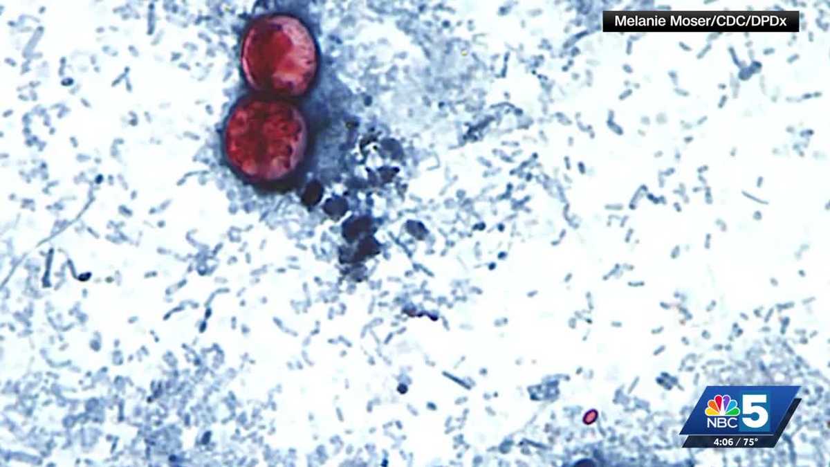 What we know about the nation-wide Cyclospora outbreak and tips from local experts