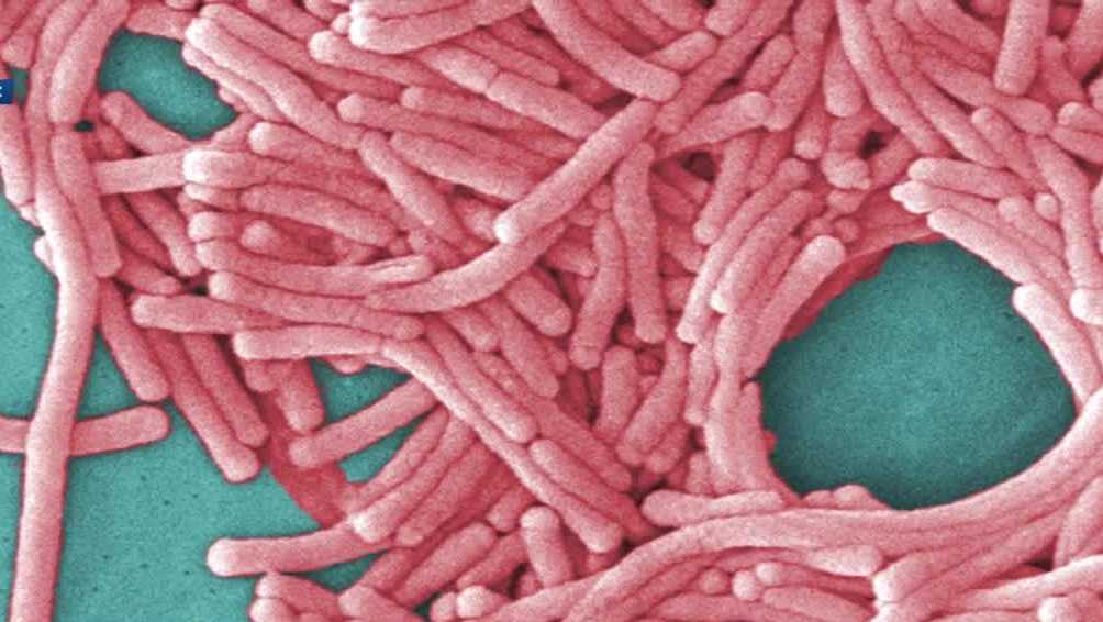 Legionnaires’ disease in two people who stayed at NH resort hotel